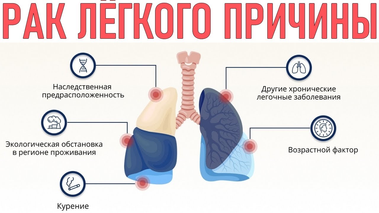 Профилактика рака легких